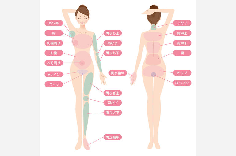 女性脱毛図